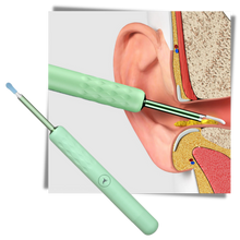 Load image into Gallery viewer, Bastone intelligente per la pulizia dell'orecchio - Ozerty