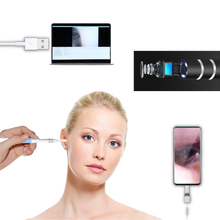 Carica l'immagine nel visualizzatore di Gallery, 3 in 1 Telecamera auricolare - Ozerty