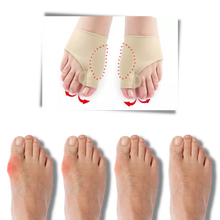 Load image into Gallery viewer, Correttore di alluce valgo in gel