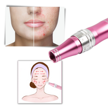 Carica l'immagine nel visualizzatore di Gallery, Penna per micro-needling dermico - Ozerty