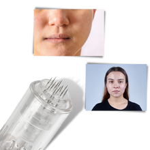 Carica l'immagine nel visualizzatore di Gallery, Penna per micro-needling dermico - Ozerty