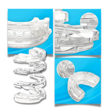 Load image into Gallery viewer, Dispositivo antirussamento avanzato - Ozerty