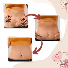 Carica l'immagine nel visualizzatore di Gallery, Massaggiatore per cellulite a vibrazione ad alta frequenza - Ozerty