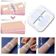 Load image into Gallery viewer, Adesivo per ferite impermeabile - Ozerty