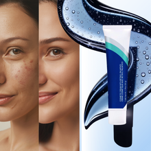 Load image into Gallery viewer, Crema Rivitalizzante al Retinolo - Ozerty