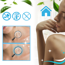 Load image into Gallery viewer, Tecnica di legatura per la rimozione - Ozerty