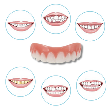 Load image into Gallery viewer, Faccette dentali a scatto - Ozerty