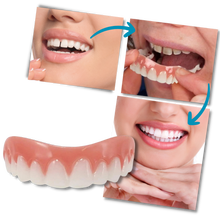 Load image into Gallery viewer, Faccette dentali a scatto - Ozerty