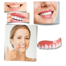 Load image into Gallery viewer, Faccette dentali a scatto - Ozerty