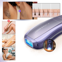 Load image into Gallery viewer, Dispositivo di Depilazione SkinSync - Ozerty