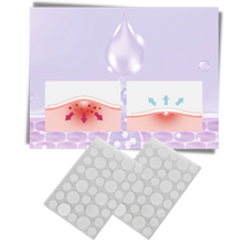 Load image into Gallery viewer, Confezione da 36 cerotti invisibili per l&#39;acne - Ozerty

