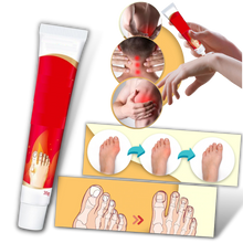 Load image into Gallery viewer, Crema antinfiammatoria per l&#39;alluce valgo - Ozerty
