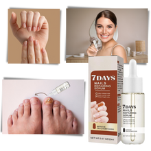 Load image into Gallery viewer, Essenza per la riparazione delle unghie 7 giorni - Ozerty

