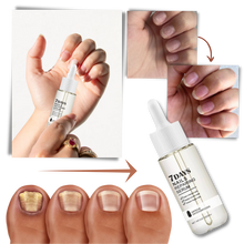 Load image into Gallery viewer, Essenza per la riparazione delle unghie 7 giorni - Ozerty
