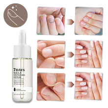 Load image into Gallery viewer, Essenza per la riparazione delle unghie 7 giorni - Ozerty
