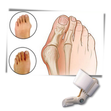 Load image into Gallery viewer, Correttore ortopedico di alluce valgo - Ozerty
