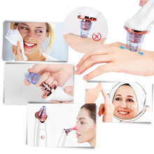 Carica l&#39;immagine nel visualizzatore di Gallery, Aspiratore per punti neri - Ozerty
