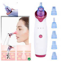 Carica l&#39;immagine nel visualizzatore di Gallery, Aspiratore per punti neri - Ozerty
