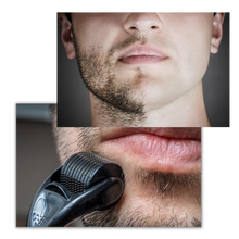 Load image into Gallery viewer, Rullo Derma per la crescita di capelli e barba
