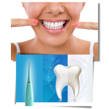 Carica l&#39;immagine nel visualizzatore di Gallery, Macchina per la pulizia profonda del tartaro dei denti
