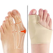 Load image into Gallery viewer, Correttore di alluce valgo in gel - Ozerty
