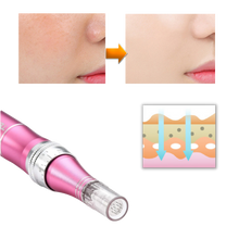 Carica l&#39;immagine nel visualizzatore di Gallery, Penna per micro-needling dermico - Ozerty
