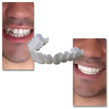 Load image into Gallery viewer, Copertura dentale del sorriso perfetto - faccette confortevoli - Ozerty
