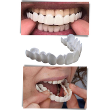 Load image into Gallery viewer, Copertura dentale del sorriso perfetto - faccette confortevoli - Ozerty
