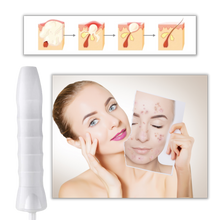Carica l&#39;immagine nel visualizzatore di Gallery, Terapia della luce anti-invecchiamento per la pelle - Ozerty
