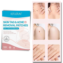Load image into Gallery viewer, Cerotto per il trattamento di rimozione delle escrescenze della pelle - Ozerty
