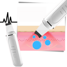 Load image into Gallery viewer, Scrubber ultrasonico per la pulizia profonda del viso - Ozerty
