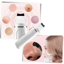 Load image into Gallery viewer, Scrubber ultrasonico per la pulizia profonda del viso
