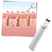 Load image into Gallery viewer, Scrubber ultrasonico per la pulizia profonda del viso - Ozerty
