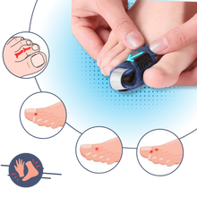 Load image into Gallery viewer, Raddrizzatore per dita dei piedi regolabile e discreto - Ozerty
