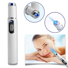 Carica l&#39;immagine nel visualizzatore di Gallery, Penna laser blu per la rimozione delle macchie scure - Ozerty
