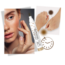 Carica l&#39;immagine nel visualizzatore di Gallery, Penna per Lentiggini a Finitura Naturale - Ozerty
