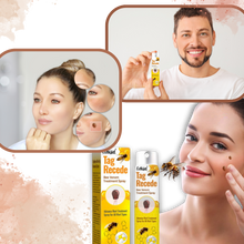 Load image into Gallery viewer, Rimuovi Escrescenze Cutanee Non-Invasivo - Ozerty
