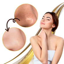 Carica l&#39;immagine nel visualizzatore di Gallery, Maschera di pulizia per i pori dorata - Ozerty
