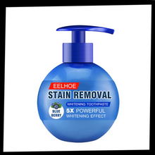 Load image into Gallery viewer, Sbiancamento rapido dei denti - Ozerty
