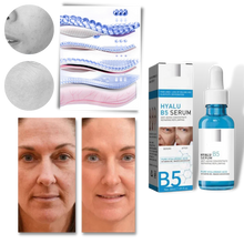 Load image into Gallery viewer, Siero ringiovanente all&#39;acido ialuronico Hyalu B5 - Ozerty
