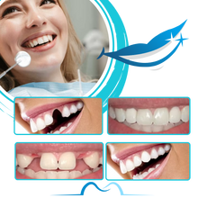 Load image into Gallery viewer, Kit per la Modellazione di Denti Finti Riutilizzabile - Ozerty
