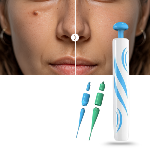 Tecnica di legatura per la rimozione - Ozerty