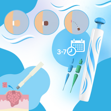 Load image into Gallery viewer, Tecnica di legatura per la rimozione - Ozerty
