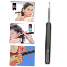 Load image into Gallery viewer, Telecamera intelligente per la rimozione del cerume dall&#39;orecchio - Ozerty
