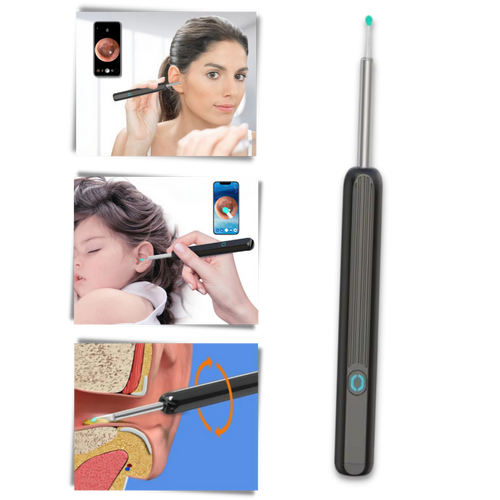 Telecamera intelligente per la rimozione del cerume dall'orecchio - Ozerty